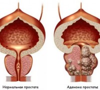 ДГПЖ: что скрывается за этими четырьмя буквами? 