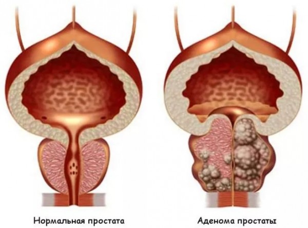 ДГПЖ: что скрывается за этими четырьмя буквами? 
