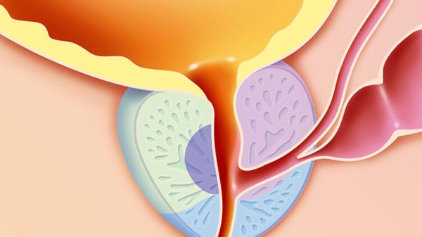 РОЛЬ КОМБИНИРОВАННОГО ФИТОПРЕПАРАТА ПРОСТОТИАЛЬ ФОРТЕ В КОМПЛЕКСНОЙ ТЕРАПИИ ХРОНИЧЕСКОГО БАКТЕРИАЛЬНОГО ПРОСТАТИТА: ВЛИЯНИЕ НА ЧАСТОТУ РЕЦИДИВОВ