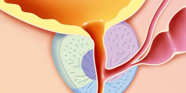 РОЛЬ КОМБИНИРОВАННОГО ФИТОПРЕПАРАТА ПРОСТОТИАЛЬ ФОРТЕ В КОМПЛЕКСНОЙ ТЕРАПИИ ХРОНИЧЕСКОГО БАКТЕРИАЛЬНОГО ПРОСТАТИТА: ВЛИЯНИЕ НА ЧАСТОТУ РЕЦИДИВОВ