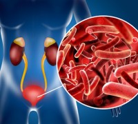 Цистит: как не допустить ошибку и вернуть комфорт?