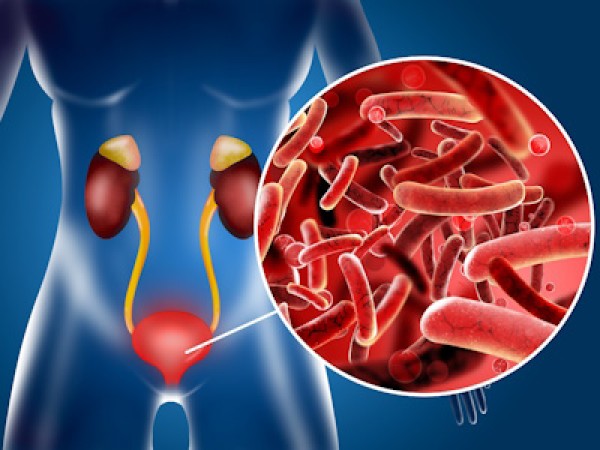 Цистит: как не допустить ошибку и вернуть комфорт?